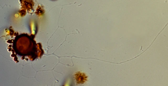 Microgromia longisaepimen