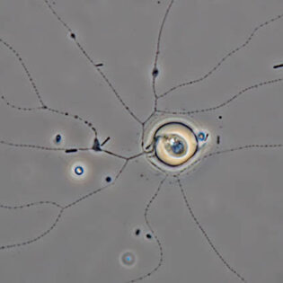 Microgromia-haeckeliana-oo-7